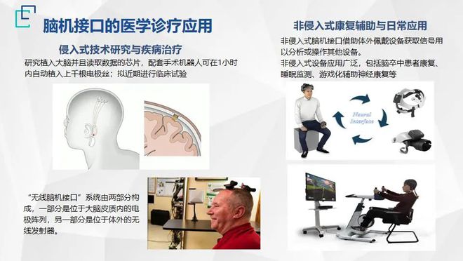 腦科疾病治療迎來新紀元 《2022北京醫工交叉創新戰略前沿技術十大趨勢》釋放關鍵信號